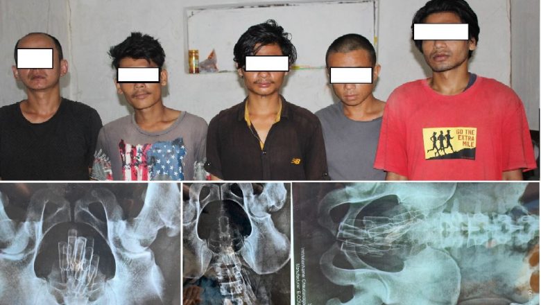 मलद्धारमा फ्रिजिङ्ग गरी लागु औषध ल्याउदै गरेको अवस्थामा बेल्टारका ५ जना पक्राउ ।